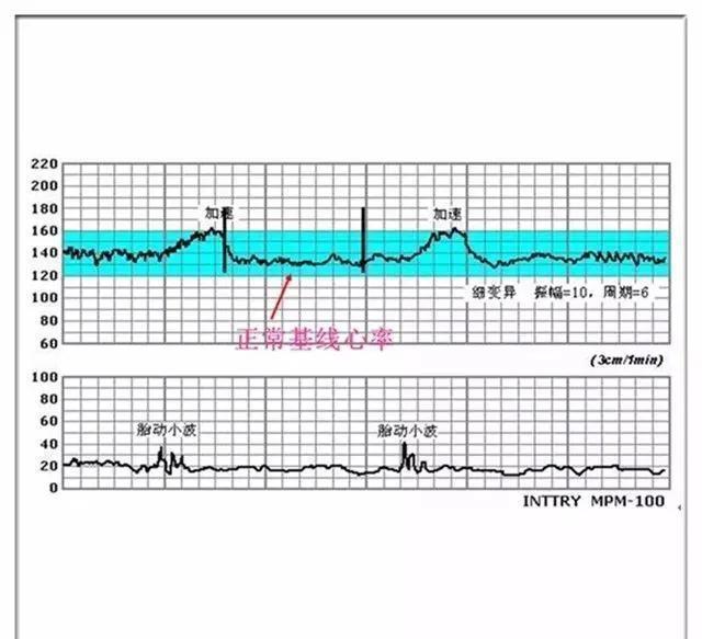 关于怀孕七个月胎心的正常数值及其重要性