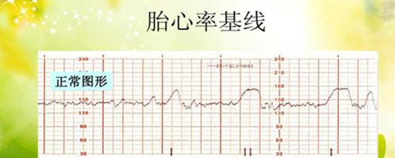 三个月胎心率多少正常，了解胎儿健康的重要指标