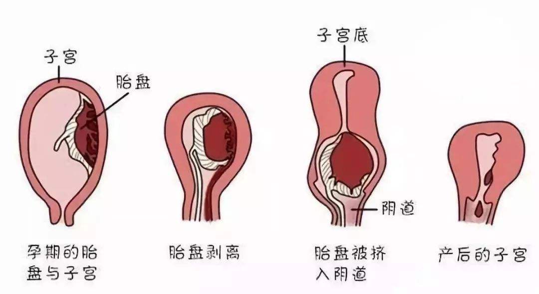 经期过后半个月又出血，原因、处理与关注